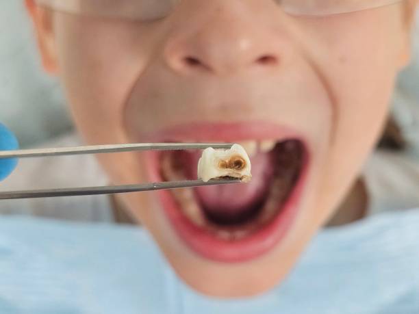 Best Emergency Treatment for Jaw Pain or Injury in Waurika, OK